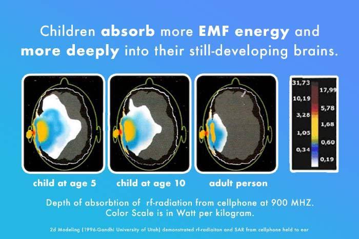 childrens brains and emf wireless energy absorption